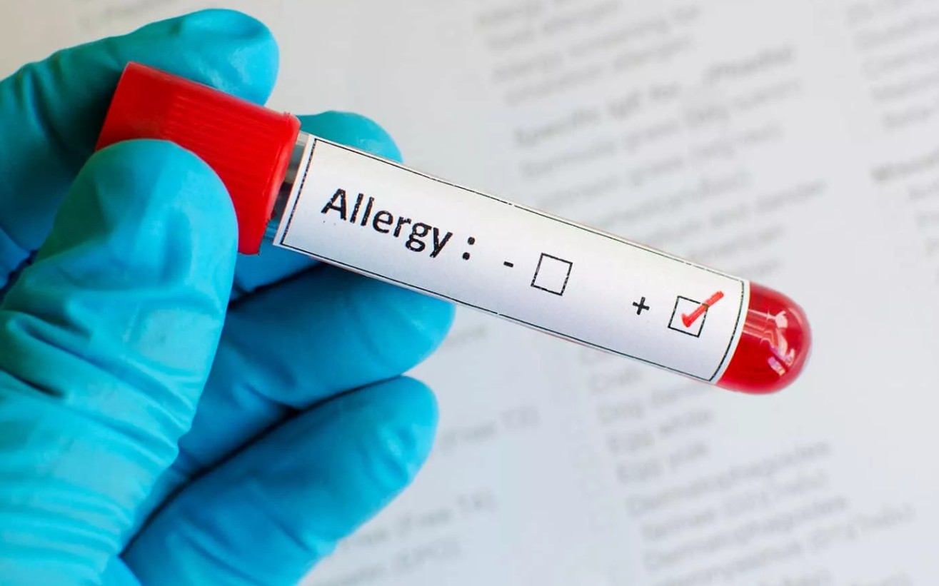 Какие виды аллергии бывают