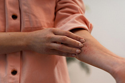 Как ухаживать за поврежденной кожей: советы и рекомендации
